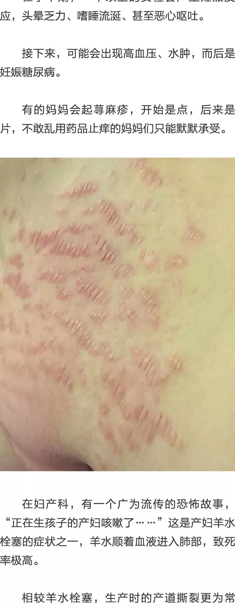 未成年脱光 并厘清其中的未成关键问题海报