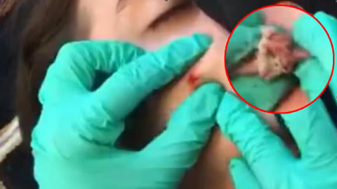 娜娜吃瓜事件 吃瓜以卡片流形式呈现内容海报