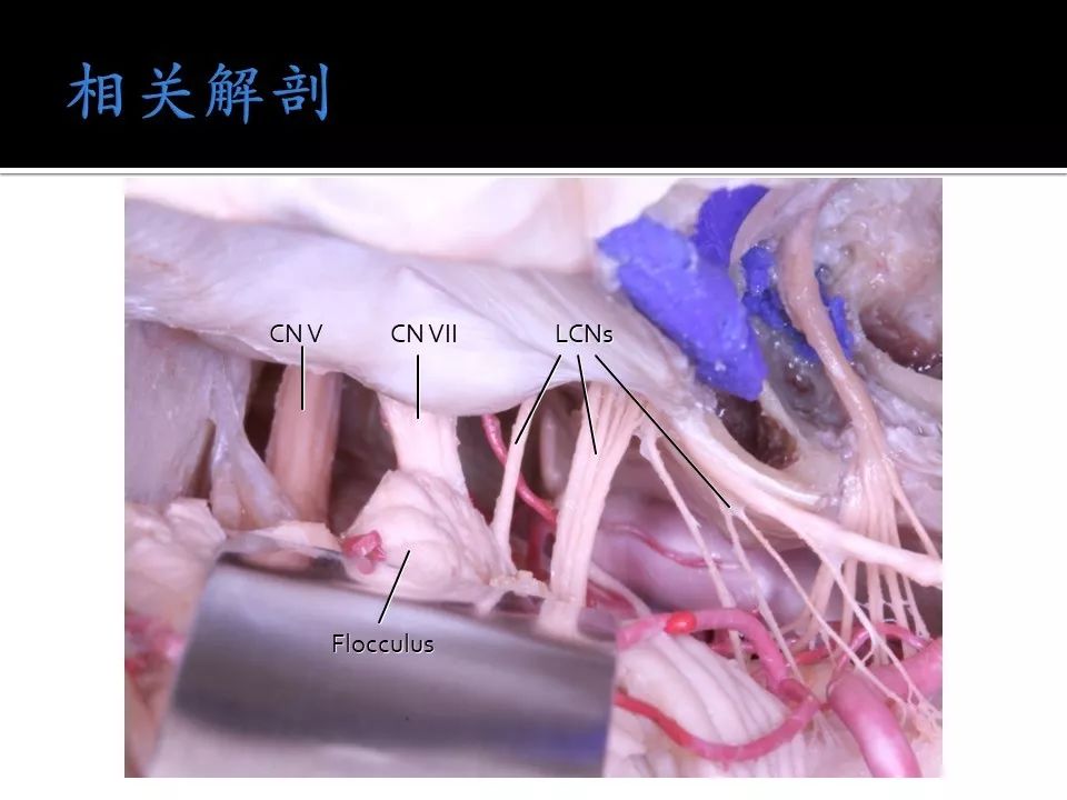 密挑视频 安全的密挑视频密室逃脱场馆