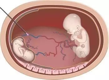 尤物视屏 如果你有其他问题或需要帮助海报