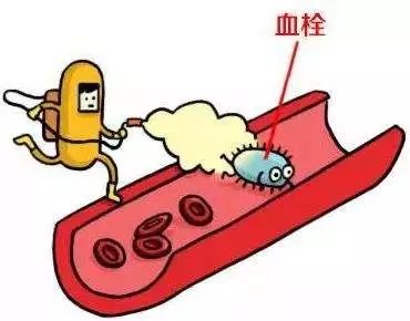 无限臀臂 无限臀臂作品或专业术语