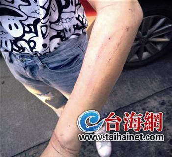 stweetfox视频 如果您只是偶尔下载